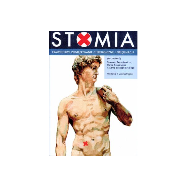 Stomia. Prawidłowe postępowanie chirurgiczne i pielęgnacja Stomia. Prawidłowe postępowanie chirurgiczne i pielęgnacja