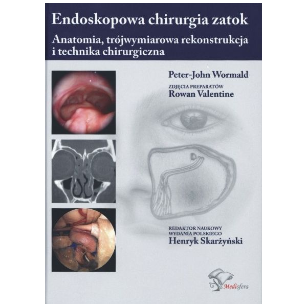 Endoskopowa chirurgia zatok Anatomia, trójwymiarowa rekonstrukcja i technika chirurgiczna