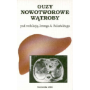 Guzy nowotworowe wątroby