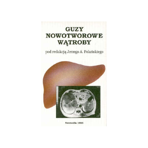 Guzy nowotworowe wątroby