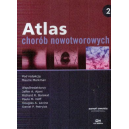 Atlas chorób nowotworowych t.2