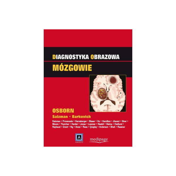 Diagnostyka obrazowa. Mózgowie Diagnostyka obrazowa. Mózgowie