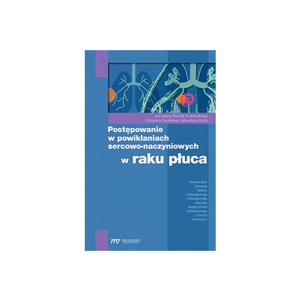 Postępowanie w powikłaniach sercowo-naczyniowych w raku płuca