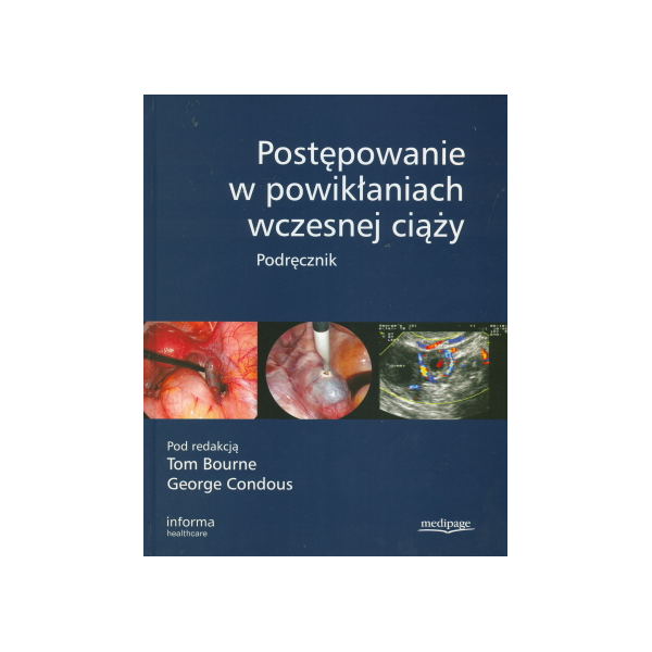 Postępowanie w powikłaniach wczesnej ciąży Podręcznik