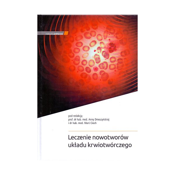 Leczenie nowotworów układu krwiotwórczego Leczenie nowotworów układu krwiotwórczego