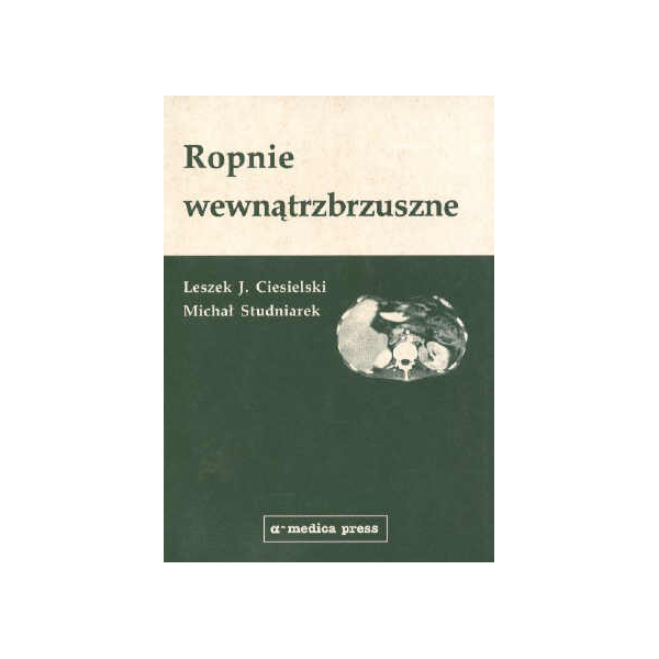 Ropnie wewnątrzbrzuszne