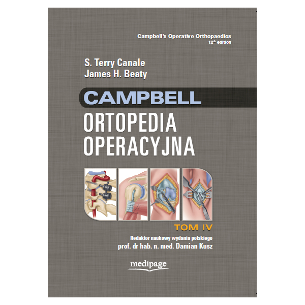 ORTOPEDIA OPERACYJNA CAMPBELL t.4 Canale,Beaty