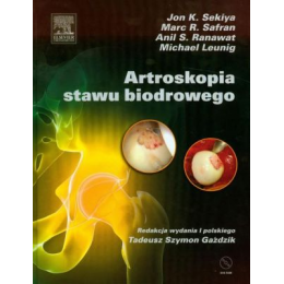 Artroskopia stawu biodrowego (z DVD)