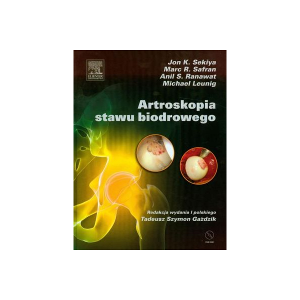 Artroskopia stawu biodrowego (z DVD)