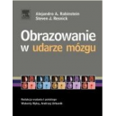 Obrazowanie w udarze mózgu 