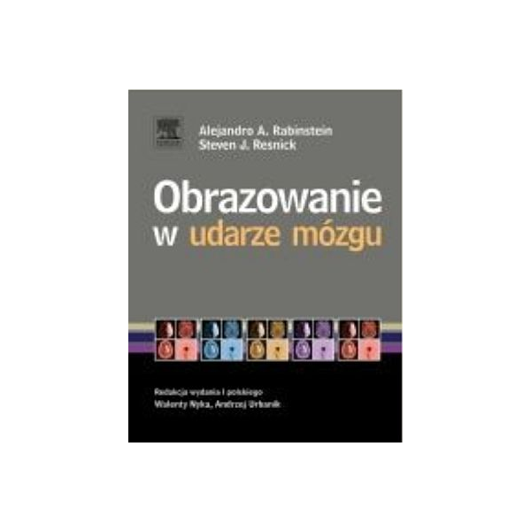 Obrazowanie w udarze mózgu 