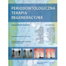 Periodontologiczna terapia regeneracyjna