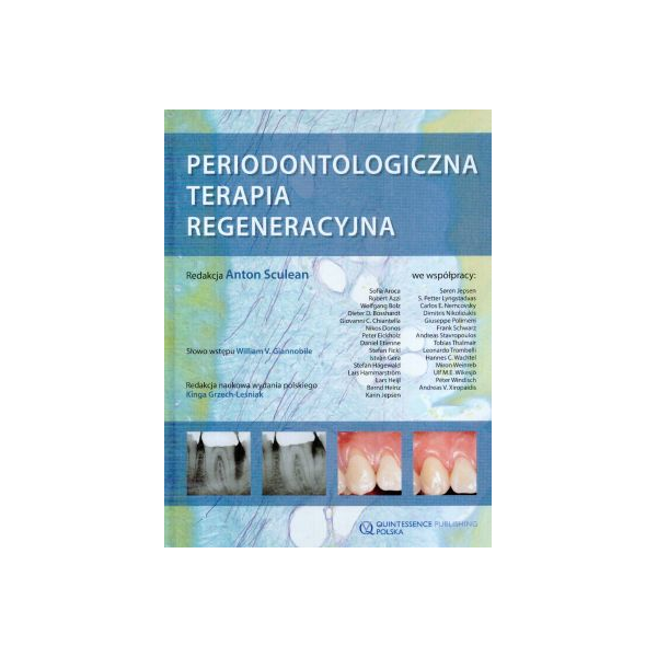 Periodontologiczna terapia regeneracyjna Periodontologiczna terapia regeneracyjna