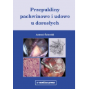 Przepukliny pachwinowe i udowe u dorosłych