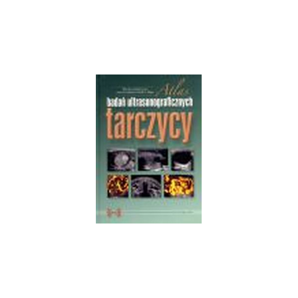 Atlas badań ultrasonograficznych tarczycy
