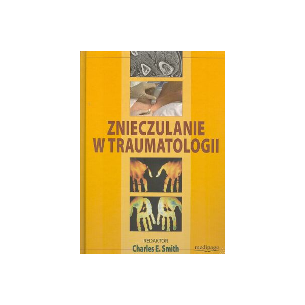 Znieczulanie w traumatologii