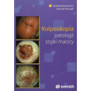 Kolposkopia patologii szyjki macicy