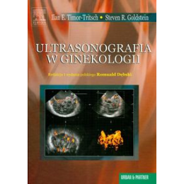 Ultrasonografia w ginekologii