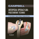 Ortopedia operacyjna Campbell 
Podstawowe techniki