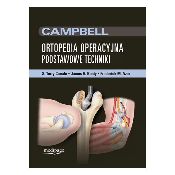 Ortopedia operacyjna Campbell 
Podstawowe techniki
