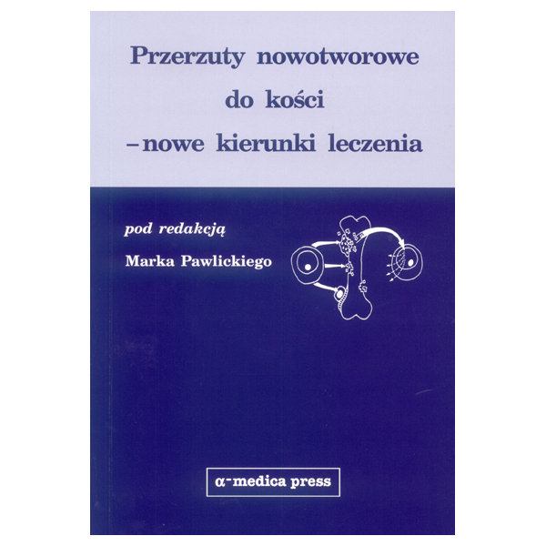 Przerzuty nowotworowe do kości Nowe kierunki leczenia