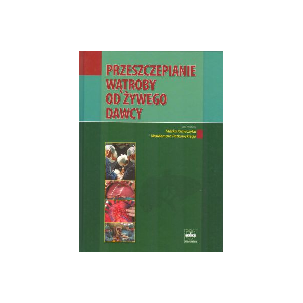 Przeszczepianie wątroby od żywego dawcy