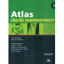 Atlas chorób nowotworowych 3