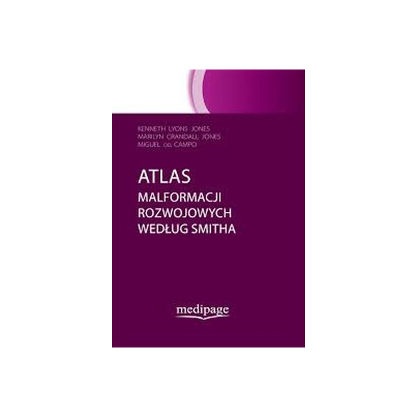 Atlas malformacji rozwojowych według Smitha