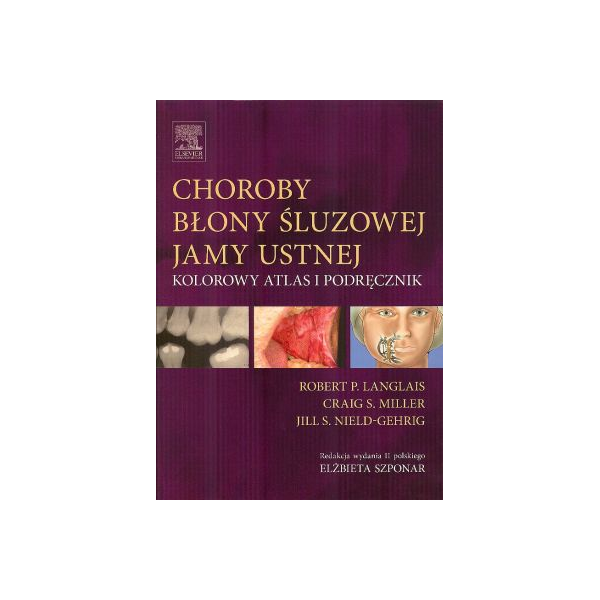 Choroby błony śluzowej jamy ustnej. Kolorowy atlas i podręcznik