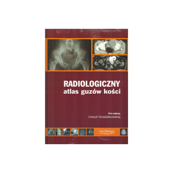 Radiologiczny atlas guzów kości