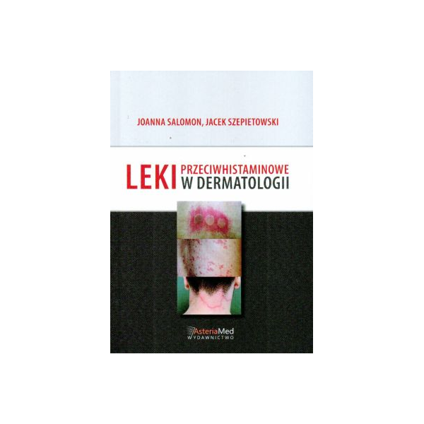 Leki przeciwhistaminowe w dermatologii