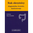 Rak okrężnicy Diagnostyka, leczenie, kontrowersje