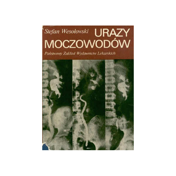 Urazy moczowodów