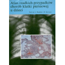 Atlas rzadkich przypadków chorób klatki piersiowej u dzieci