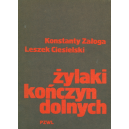 Żylaki kończyn dolnych