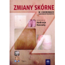 Zmiany skórne w chorobach ogólnoustrojowych t.1