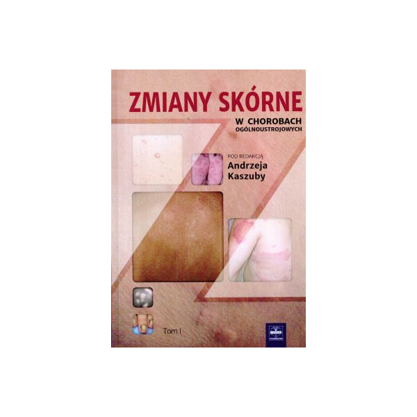 Zmiany skórne w chorobach ogólnoustrojowych t.1