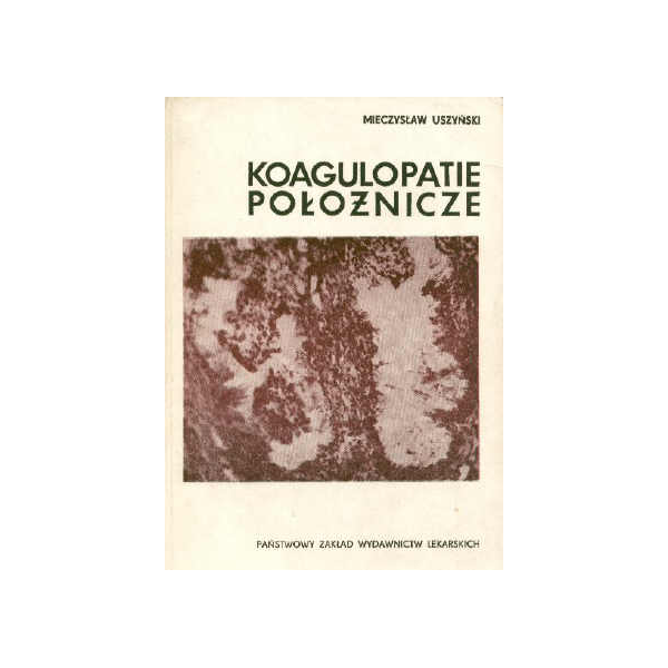 Koagulopatie położnicze