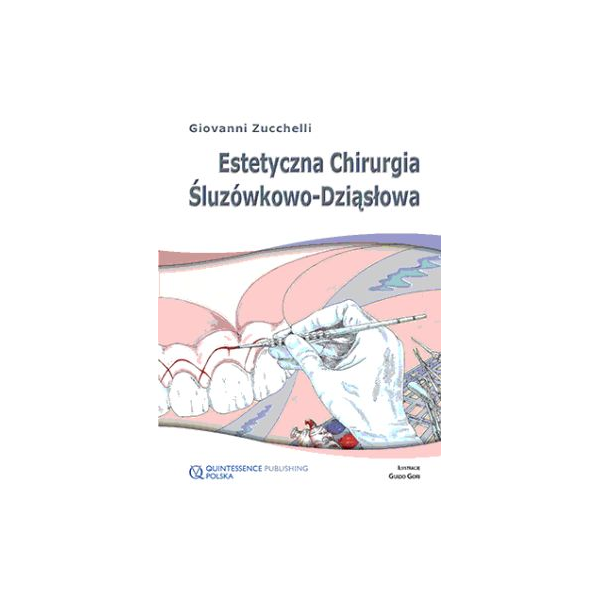 Estetetyczna chirurgia śluzówkowo-dziąsłowa