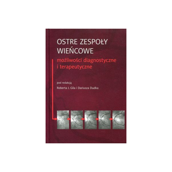 Ostre zespoły wieńcowe z CD
możliwości diagnostyczne i terapeutyczne