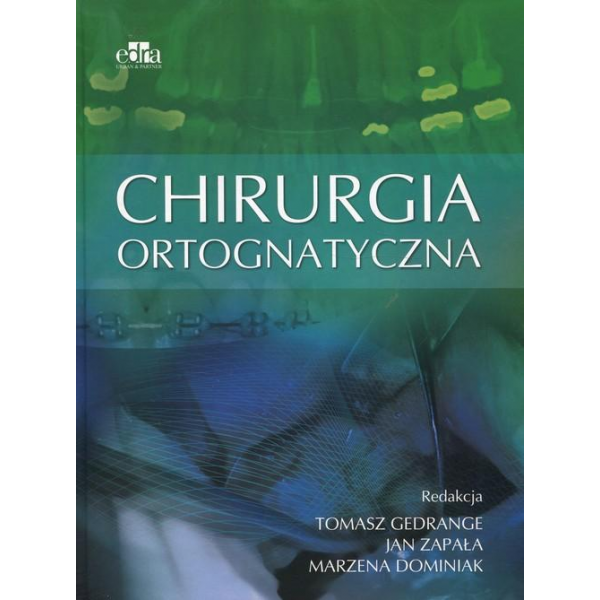 Chirurgia ortognatyczna