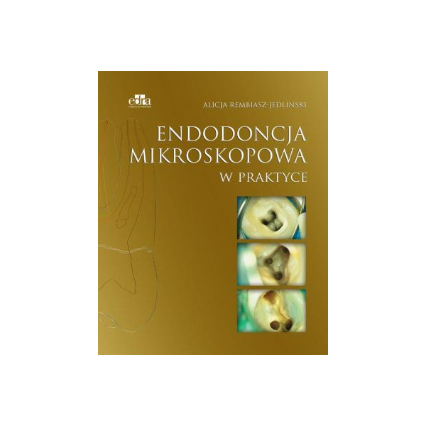 Endodoncja mikroskopowa w praktyce