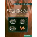 Ultrasonografia w ginekologii