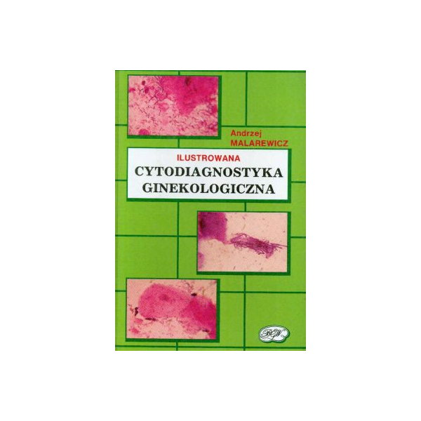 Ilustrowana cytodiagnostyka ginekologiczna