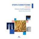 Stopa cukrzycowa - atlas historie chorób pacjentów