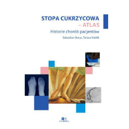 Stopa cukrzycowa - atlas historie chorób pacjentów