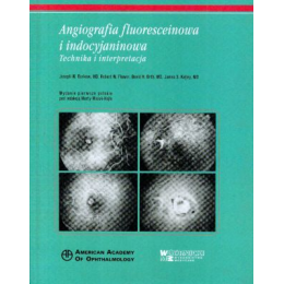 Angiografia fluoresceinowa i indocyjaninowa
Technika i interpretacje