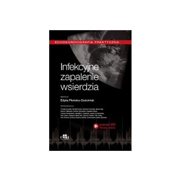 Infekcyjne zapalenie wsierdzia Echokardiografia praktyczna Infekcyjne zapalenie wsierdzia Echokardiografia praktyczna