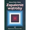 Zapalenie wątroby Diagnostyka, terapia i zapobieganie u chorych z ostrymi i przewlekłymi chorobami wątroby w praktyce