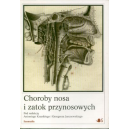 Choroby nosa i zatok przynosowych